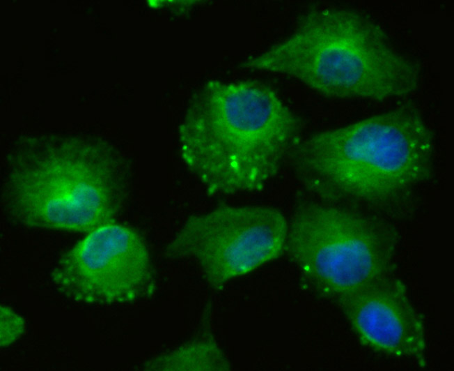 ICC staining of LOXL2 in HUVEC cells (green). Formalin fixed cells were permeabilized with 0.1% Triton X-100 in TBS for 10 minutes at room temperature and blocked with 10% negative goat serum for 15 minutes at room temperature. Cells were probed with the primary antibody (ET1706-11, 1/50) for 1 hour at room temperature, washed with PBS. Alexa Fluor®488 Goat anti-Rabbit IgG was used as the secondary antibody at 1/1,000 dilution. The nuclear counter stain is DAPI (blue).