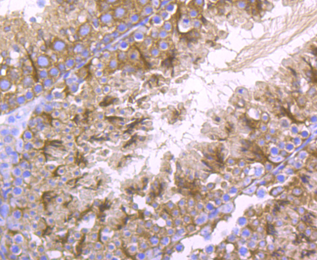 Immunohistochemical analysis of paraffin-embedded mouse testis tissue with Rabbit anti-LOXL2 antibody (ET1706-11) at 1/50 dilution.<br />
<br />
The section was pre-treated using heat mediated antigen retrieval with Tris-EDTA buffer (pH 9.0) for 20 minutes. The tissues were blocked in 1% BSA for 20 minutes at room temperature, washed with ddH2O and PBS, and then probed with the primary antibody (ET1706-11) at 1/50 dilution for 0.5 hour at room temperature. The detection was performed using an HRP conjugated compact polymer system. DAB was used as the chromogen. Tissues were counterstained with hematoxylin and mounted with DPX.