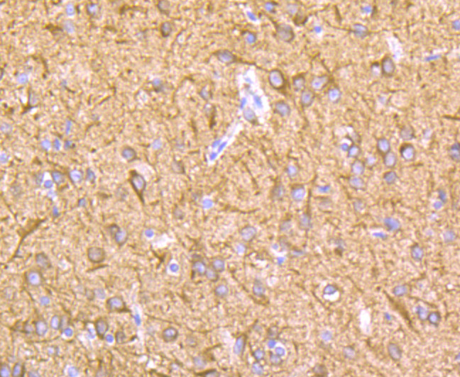 Immunohistochemical analysis of paraffin-embedded rat brain tissue using anti-LOXL2 antibody. The section was pre-treated using heat mediated antigen retrieval with Tris-EDTA buffer (pH 9.0) for 20 minutes.The tissues were blocked in 5% BSA for 30 minutes at room temperature, washed with ddH2O and PBS, and then probed with the primary antibody (ET1706-11, 1/50) for 30 minutes at room temperature. The detection was performed using an HRP conjugated compact polymer system. DAB was used as the chromogen. Tissues were counterstained with hematoxylin and mounted with DPX.