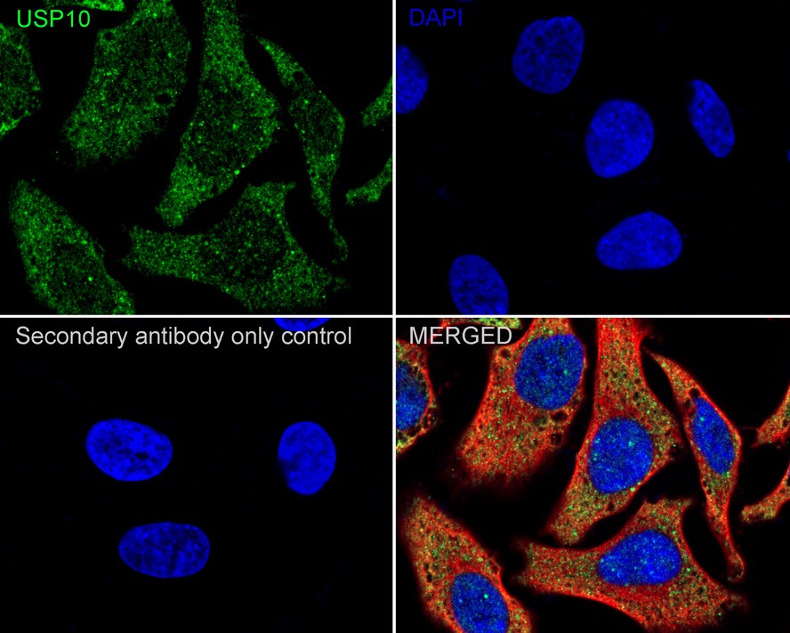 Immunocytochemistry analysis of Hela  cells labeling USP10 with Rabbit anti-USP10 antibody (ET1706-12) at 1/50 dilution.<br />
<br />
Cells were fixed in 4% paraformaldehyde for 10 minutes at 37 ℃, permeabilized with 0.05% Triton X-100 in PBS for 20 minutes, and then blocked with 2% negative goat serum for 30 minutes at room temperature. Cells were then incubated with Rabbit anti-USP10 antibody (ET1706-12) at 1/50 dilution in 2% negative goat serum overnight at 4 ℃. Alexa Fluor®488 conjugate-Goat anti-Rabbit IgG was used as the secondary antibody at 1/1,000 dilution. Nuclear DNA was labelled in blue with DAPI.