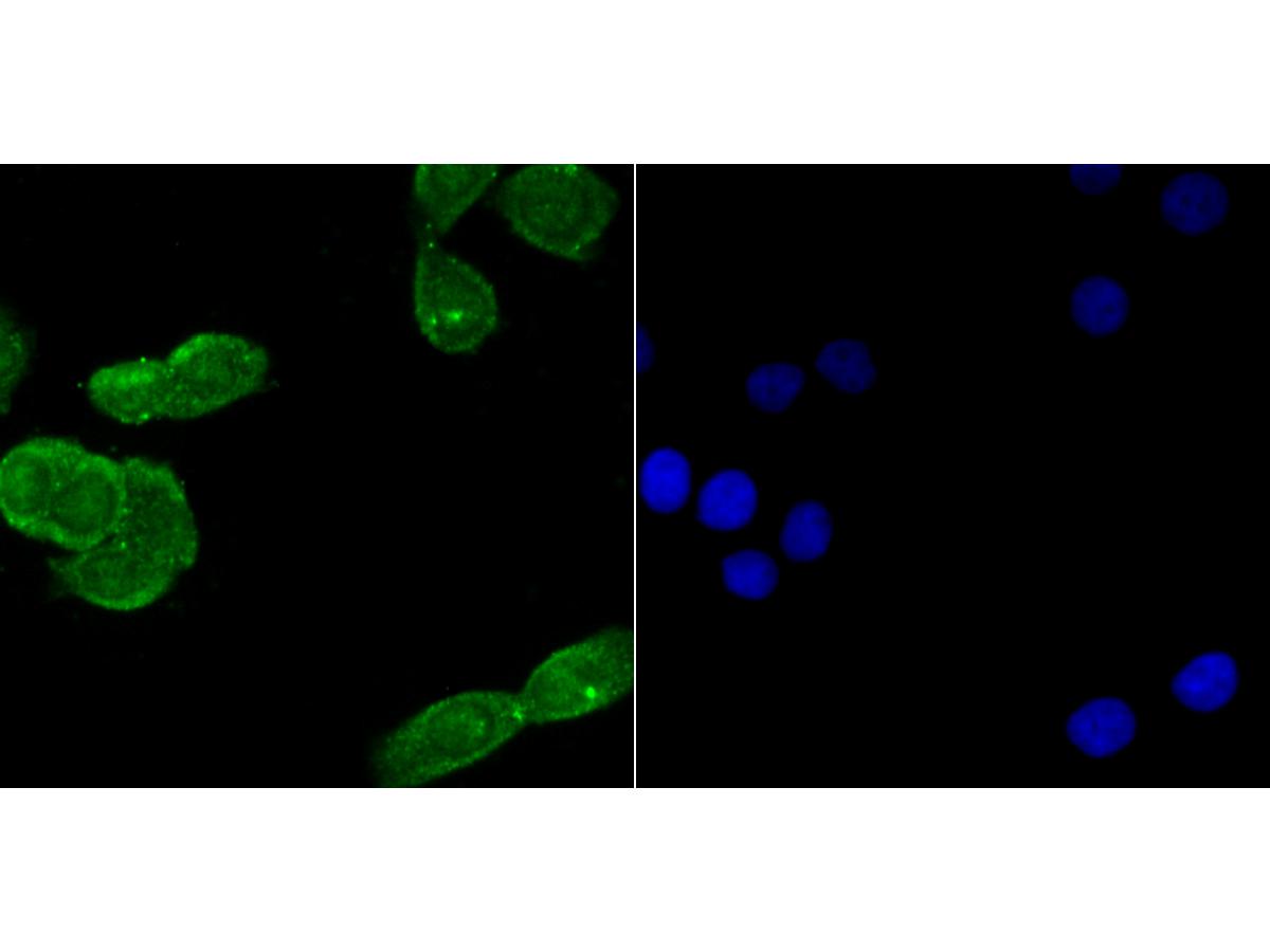 ICC staining USP22 in LOVO cells (green). The nuclear counter stain is DAPI (blue). Cells were fixed in paraformaldehyde, permeabilised with 0.25% Triton X100/PBS.
