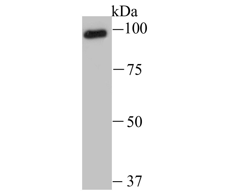 Western blot analysis of USP13 on mouse testis tissue lysates with Rabbit anti-USP13 antibody (ET1706-14) at 1/500 dilution.<br />
<br />
Lysates/proteins at 20 µg/Lane.<br />
<br />
Predicted band size: 97 kDa<br />
Observed band size: 97 kDa<br />
<br />
Exposure time: 2 minutes;<br />
<br />
8% SDS-PAGE gel.<br />
<br />
Proteins were transferred to a PVDF membrane and blocked with 5% NFDM/TBST for 1 hour at room temperature. The primary antibody (ET1706-14) at 1/500 dilution was used in 5% NFDM/TBST at room temperature for 2 hours. Goat Anti-Rabbit IgG - HRP Secondary Antibody (HA1001) at 1:200,000 dilution was used for 1 hour at room temperature.