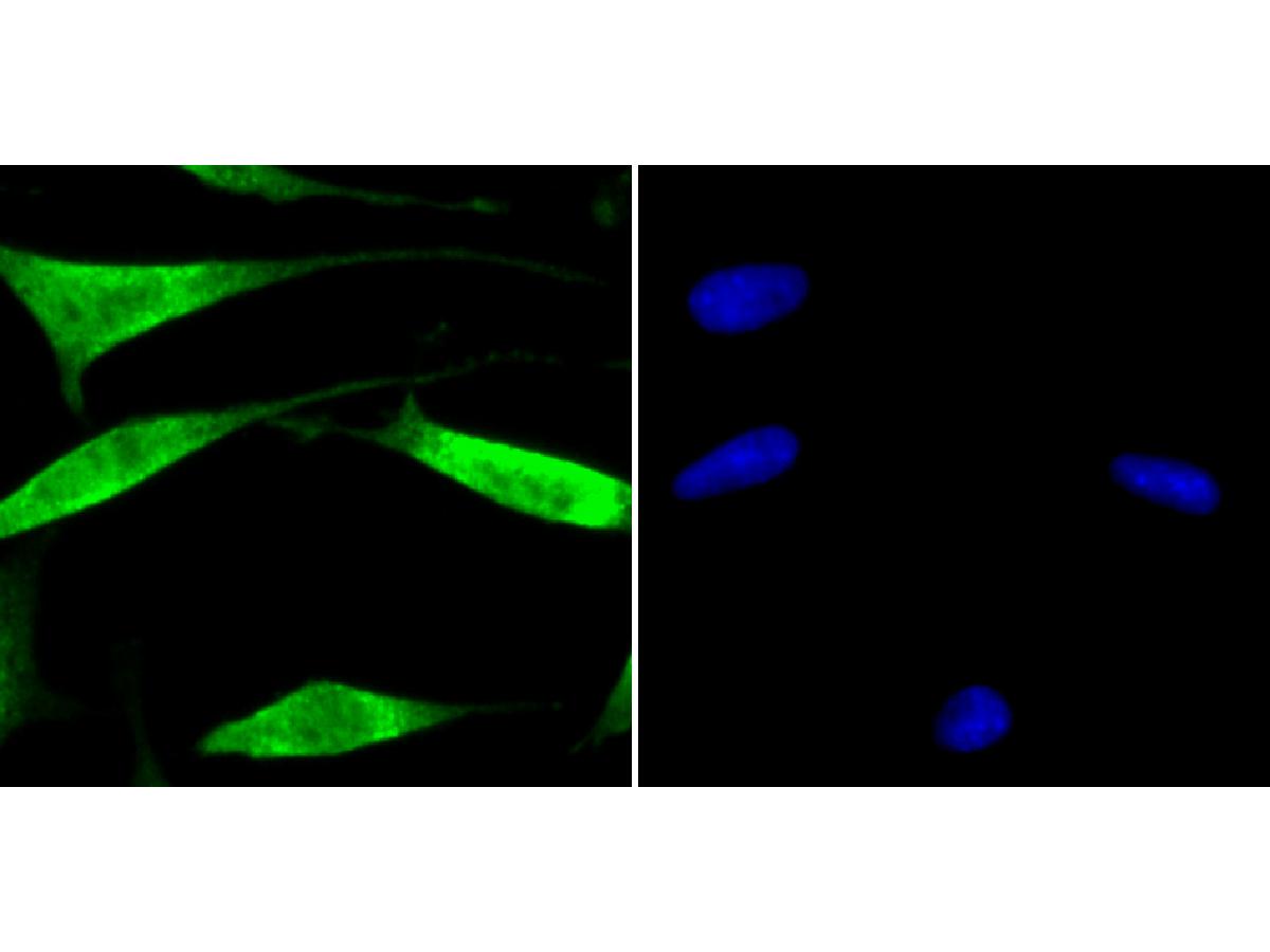 ICC staining USP13 in SH-SY5Y cells (green). The nuclear counter stain is DAPI (blue). Cells were fixed in paraformaldehyde, permeabilised with 0.25% Triton X100/PBS.