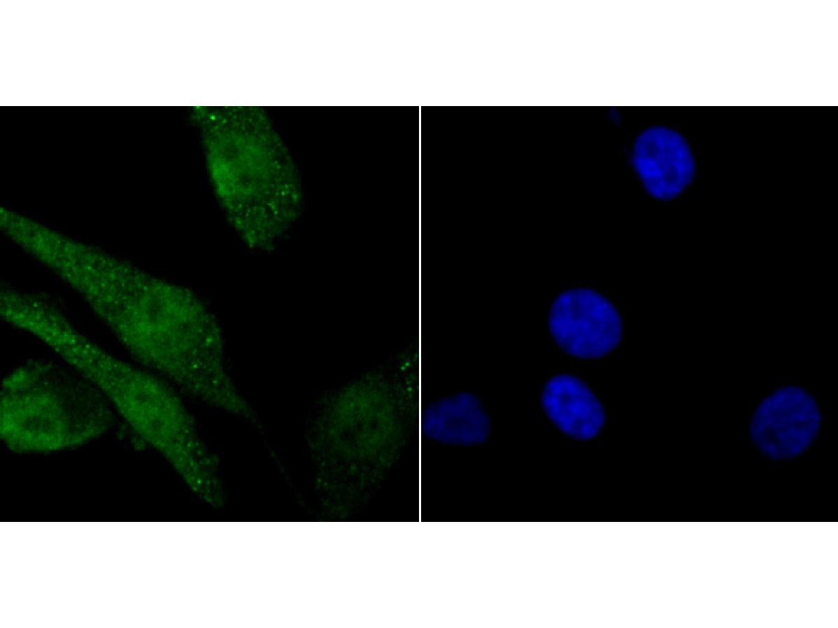 Immunocytochemistry analysis of PC-3M cells labeling macroH2A.1 with Rabbit anti-macroH2A.1 antibody (ET1706-15) at 1/50 dilution.<br />
<br />
Cells were fixed in 4% paraformaldehyde for 10 minutes at 37 ℃, permeabilized with 0.05% Triton X-100 in PBS for 20 minutes, and then blocked with 2% negative goat serum for 30 minutes at room temperature. Cells were then incubated with Rabbit anti-macroH2A.1 antibody (ET1706-15) at 1/50 dilution in 2% negative goat serum overnight at 4 ℃. Alexa Fluor®488 conjugate-Goat anti-Rabbit IgG was used as the secondary antibody at 1/1,000 dilution. Nuclear DNA was labelled in blue with DAPI.