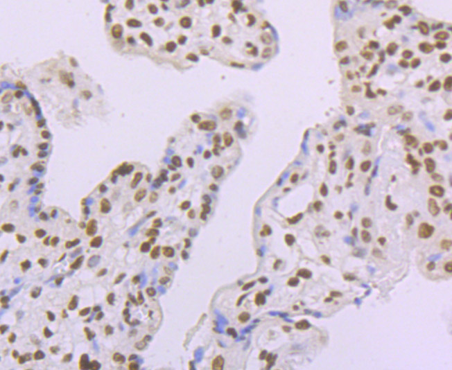 Immunohistochemical analysis of paraffin-embedded human placenta tissue with Rabbit anti-macroH2A.1 antibody (ET1706-15) at 1/50 dilution.<br />
<br />
The section was pre-treated using heat mediated antigen retrieval with sodium citrate buffer (pH 6.0) for 2 minutes. The tissues were blocked in 1% BSA for 20 minutes at room temperature, washed with ddH2O and PBS, and then probed with the primary antibody (ET1706-15) at 1/50 dilution for 1 hour at room temperature. The detection was performed using an HRP conjugated compact polymer system. DAB was used as the chromogen. Tissues were counterstained with hematoxylin and mounted with DPX.