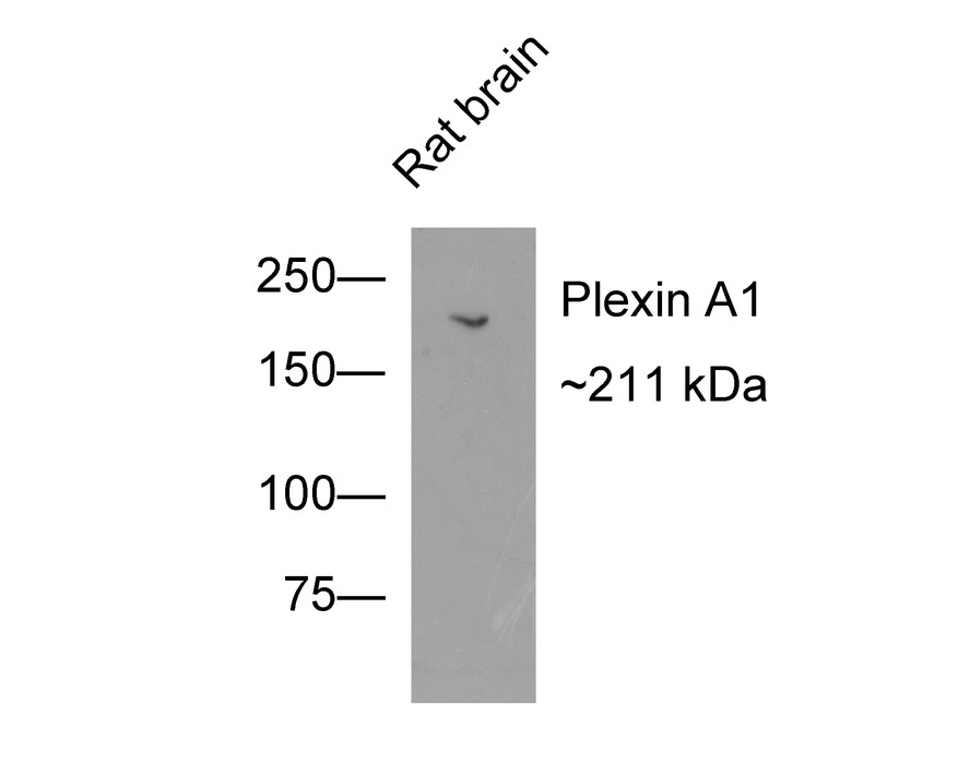 ICC staining of Plexin A1 in LOVO cells (green). Formalin fixed cells were permeabilized with 0.1% Triton X-100 in TBS for 10 minutes at room temperature and blocked with 10% negative goat serum for 15 minutes at room temperature. Cells were probed with the primary antibody (ET1706-17, 1/50) for 1 hour at room temperature, washed with PBS. Alexa Fluor®488 conjugate-Goat anti-Rabbit IgG was used as the secondary antibody at 1/1,000 dilution. The nuclear counter stain is DAPI (blue).
