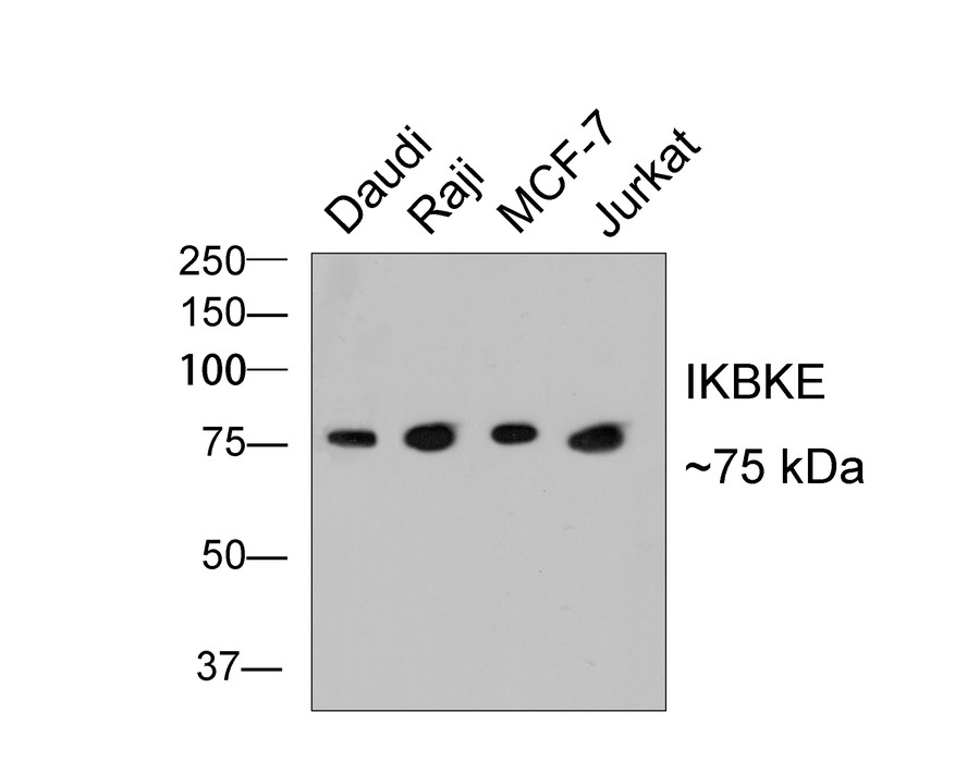 Western blot analysis of IKBKE on different lysates with Rabbit anti-IKBKE antibody (ET1706-20) at 1/500 dilution.<br />
<br />
 Lane 1: Daudi cell lysates<br />
 Lane 2: Raji cell lysates<br />
 Lane 3: MCF-7 cell lysates<br />
Lane 4: Jurkat cell lysates<br />
<br />
<br />
Lysates/proteins at 10 µg/Lane.<br />
<br />
Predicted band size: 80 kDa<br />
Observed band size: 75 kDa<br />
<br />
Exposure time: 2 minutes;<br />
<br />
8% SDS-PAGE gel.<br />
<br />
Proteins were transferred to a PVDF membrane and blocked with 5% NFDM/TBST for 1 hour at room temperature. The primary antibody (ET1706-20) at 1/500 dilution was used in 5% NFDM/TBST at room temperature for 2 hours. Goat Anti-Rabbit IgG - HRP Secondary Antibody (HA1001) at 5,000 dilution was used for 1 hour at room temperature.