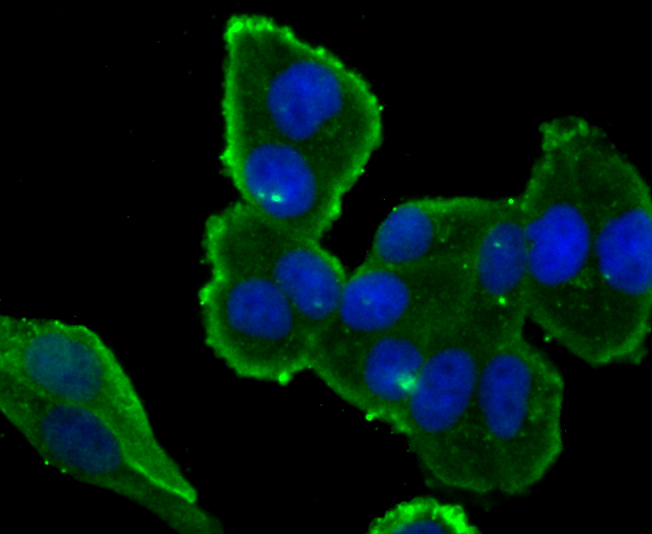 ICC staining IKBKE in Hela cells (green). The nuclear counter stain is DAPI (blue). Cells were fixed in paraformaldehyde, permeabilised with 0.25% Triton X100/PBS.