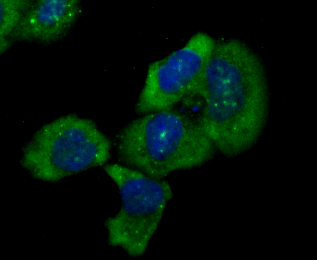 ICC staining IKBKE in JAR cells (green). The nuclear counter stain is DAPI (blue). Cells were fixed in paraformaldehyde, permeabilised with 0.25% Triton X100/PBS.