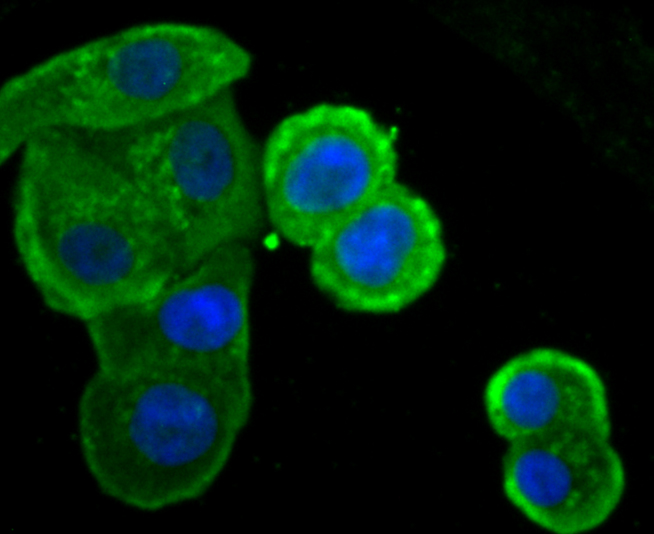 ICC staining IKBKE in SK-Br-3 cells (green). The nuclear counter stain is DAPI (blue). Cells were fixed in paraformaldehyde, permeabilised with 0.25% Triton X100/PBS.