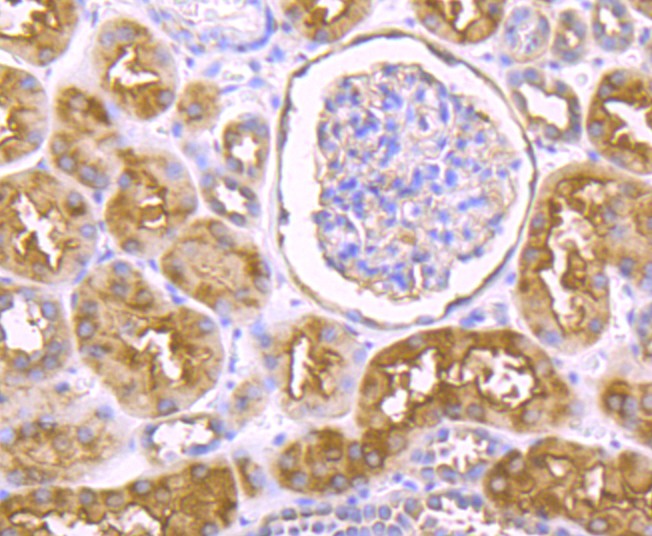 Immunohistochemical analysis of paraffin-embedded human kidney tissue with Rabbit anti-IKBKE antibody (ET1706-20) at 1/50 dilution.<br />
<br />
The section was pre-treated using heat mediated antigen retrieval with Tris-EDTA buffer (pH 8.0-8.4) for 20 minutes. The tissues were blocked in 1% BSA for 20 minutes at room temperature, washed with ddH2O and PBS, and then probed with the primary antibody (ET1706-20) at 1/50 dilution for 0.5 hour at room temperature. The detection was performed using an HRP conjugated compact polymer system. DAB was used as the chromogen. Tissues were counterstained with hematoxylin and mounted with DPX.