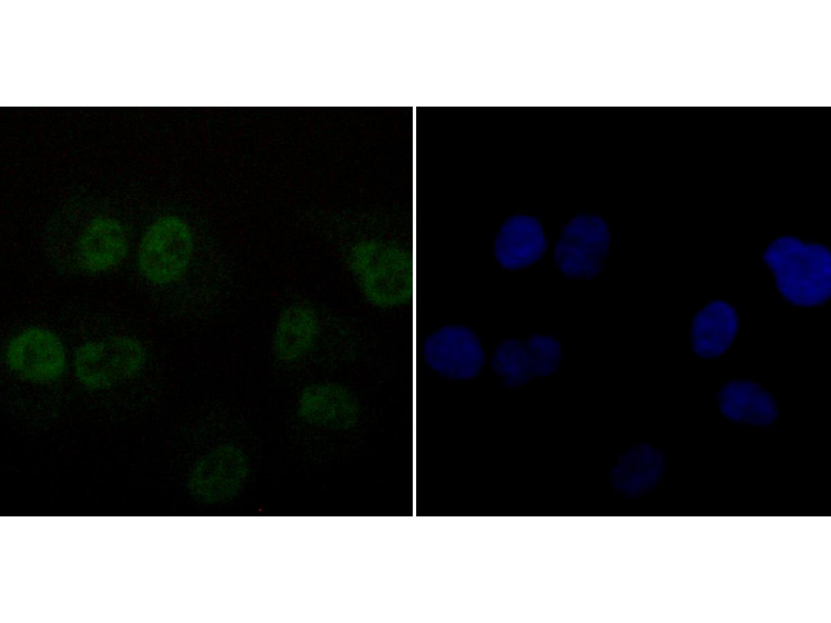 ICC staining of DDB1 in SH-SY5Y cells (green). Formalin fixed cells were permeabilized with 0.1% Triton X-100 in TBS for 10 minutes at room temperature and blocked with 10% negative goat serum for 15 minutes at room temperature. Cells were probed with the primary antibody (ET1706-22, 1/50) for 1 hour at room temperature, washed with PBS. Alexa Fluor®488 conjugate-Goat anti-Rabbit IgG was used as the secondary antibody at 1/1,000 dilution. The nuclear counter stain is DAPI (blue).