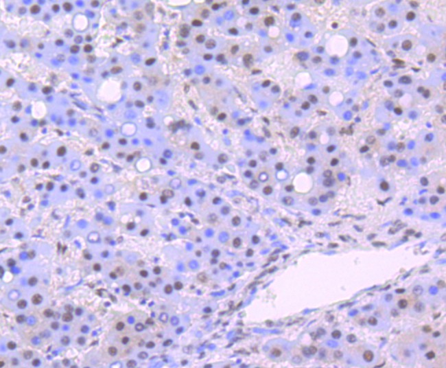 Immunohistochemical analysis of paraffin-embedded human kidney tissue using anti-DDB1 antibody. The section was pre-treated using heat mediated antigen retrieval with Tris-EDTA buffer (pH 9.0) for 20 minutes.The tissues were blocked in 1% BSA for 30 minutes at room temperature, washed with ddH2O and PBS, and then probed with the primary antibody (ET1706-22, 1/50) for 30 minutes at room temperature. The detection was performed using an HRP conjugated compact polymer system. DAB was used as the chromogen. Tissues were counterstained with hematoxylin and mounted with DPX.