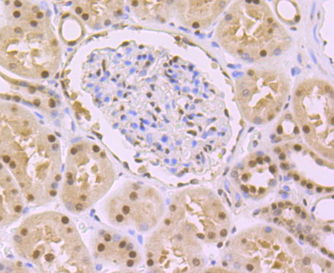 Immunohistochemical analysis of paraffin-embedded mouse brain tissue using anti-DDB1 antibody. The section was pre-treated using heat mediated antigen retrieval with Tris-EDTA buffer (pH 9.0) for 20 minutes.The tissues were blocked in 1% BSA for 30 minutes at room temperature, washed with ddH2O and PBS, and then probed with the primary antibody (ET1706-22, 1/50) for 30 minutes at room temperature. The detection was performed using an HRP conjugated compact polymer system. DAB was used as the chromogen. Tissues were counterstained with hematoxylin and mounted with DPX.