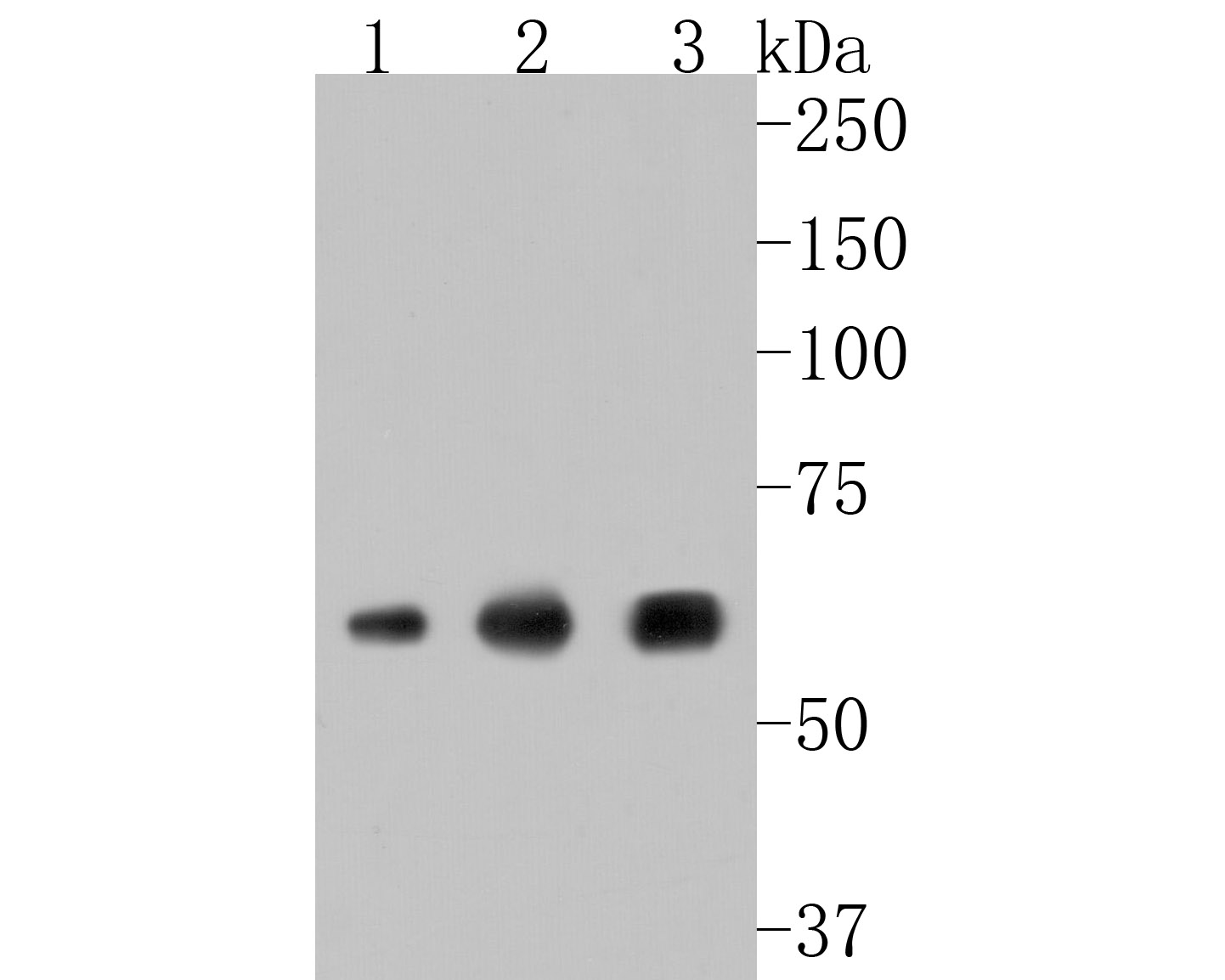 Western blot analysis of alpha Internexin on different lysates with Rabbit anti-alpha Internexin antibody (ET1706-23) at 1/500 dilution.<br />
<br />
Lane 1: A549 cell lysate<br />
Lane 2: mouse brain tissue lysate(20 µg/Lane)<br />
Lane 3: PC-12 cell lysate<br />
<br />
Lysates/proteins at 10 µg/Lane.<br />
<br />
Predicted band size: 55 kDa<br />
Observed band size: 55 kDa<br />
<br />
Exposure time: 2 minutes;<br />
<br />
10% SDS-PAGE gel.<br />
<br />
Proteins were transferred to a PVDF membrane and blocked with 5% NFDM/TBST for 1 hour at room temperature. The primary antibody (ET1706-23) at 1/500 dilution was used in 5% NFDM/TBST at room temperature for 2 hours. Goat Anti-Rabbit IgG - HRP Secondary Antibody (HA1001) at 200,000 dilution was used for 1 hour at room temperature.