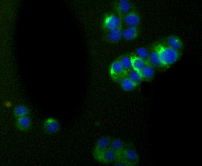 Immunocytochemistry analysis of PC-12 cells labeling alpha Internexin with Rabbit anti-alpha Internexin antibody (ET1706-23) at 1/50 dilution.<br />
<br />
Cells were fixed in 4% paraformaldehyde for 10 minutes at 37 ℃, permeabilized with 0.05% Triton X-100 in PBS for 20 minutes, and then blocked with 2% negative goat serum for 30 minutes at room temperature. Cells were then incubated with Rabbit anti-alpha Internexin antibody (ET1706-23) at 1/50 dilution in 2% negative goat serum overnight at 4 ℃. Alexa Fluor®488 conjugate-Goat anti-Rabbit IgG was used as the secondary antibody at 1/1,000 dilution. Nuclear DNA was labelled in blue with DAPI.