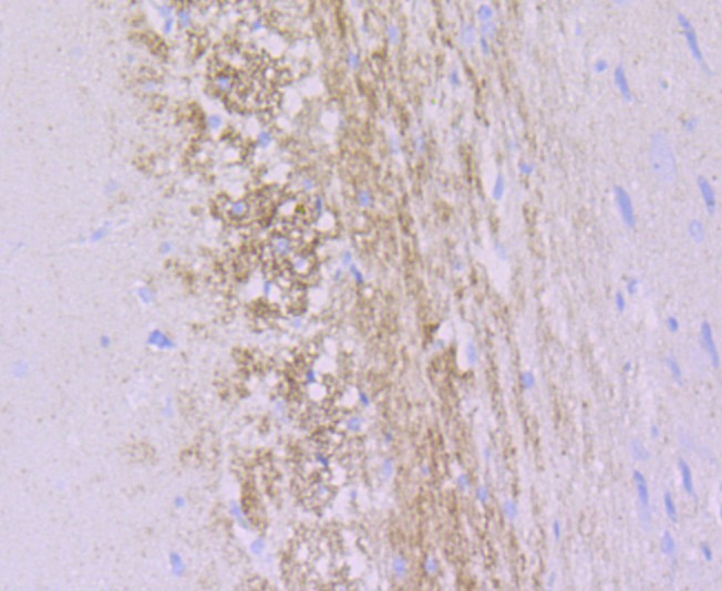 Immunohistochemical analysis of paraffin-embedded rat brain tissue with Rabbit anti-alpha Internexin antibody (ET1706-23) at 1/50 dilution.<br />
<br />
The section was pre-treated using heat mediated antigen retrieval with Tris-EDTA buffer (pH 8.0-8.4) for 20 minutes. The tissues were blocked in 1% BSA for 20 minutes at room temperature, washed with ddH2O and PBS, and then probed with the primary antibody (ET1706-23) at 1/50 dilution for 0.5 hour at room temperature. The detection was performed using an HRP conjugated compact polymer system. DAB was used as the chromogen. Tissues were counterstained with hematoxylin and mounted with DPX.
