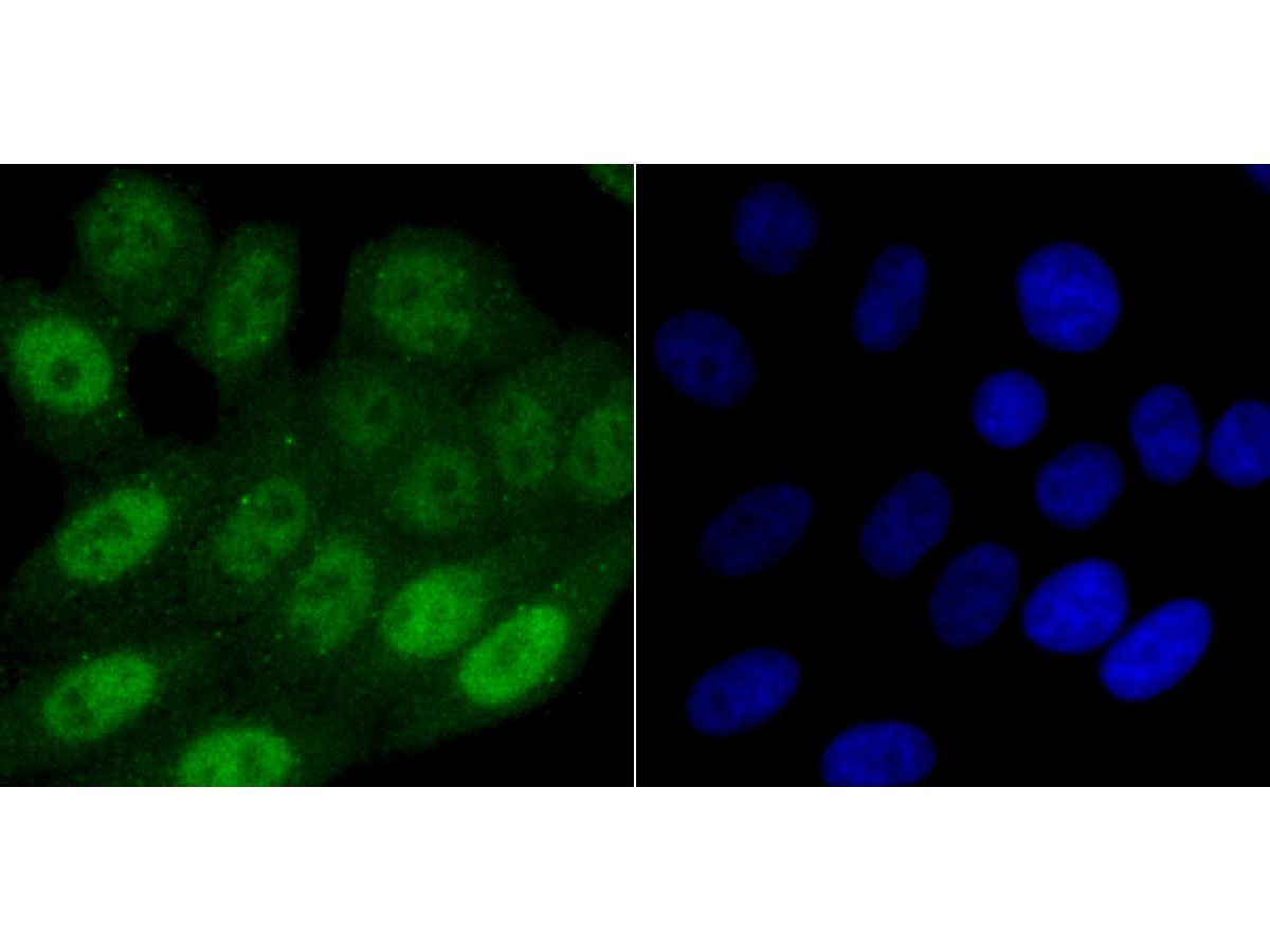 ICC staining of SAMHD1 in HepG2 cells (green). Formalin fixed cells were permeabilized with 0.1% Triton X-100 in TBS for 10 minutes at room temperature and blocked with 10% negative goat serum for 15 minutes at room temperature. Cells were probed with the primary antibody (ET1706-24, 1/50) for 1 hour at room temperature, washed with PBS. Alexa Fluor®488 conjugate-Goat anti-Rabbit IgG was used as the secondary antibody at 1/1,000 dilution. The nuclear counter stain is DAPI (blue).