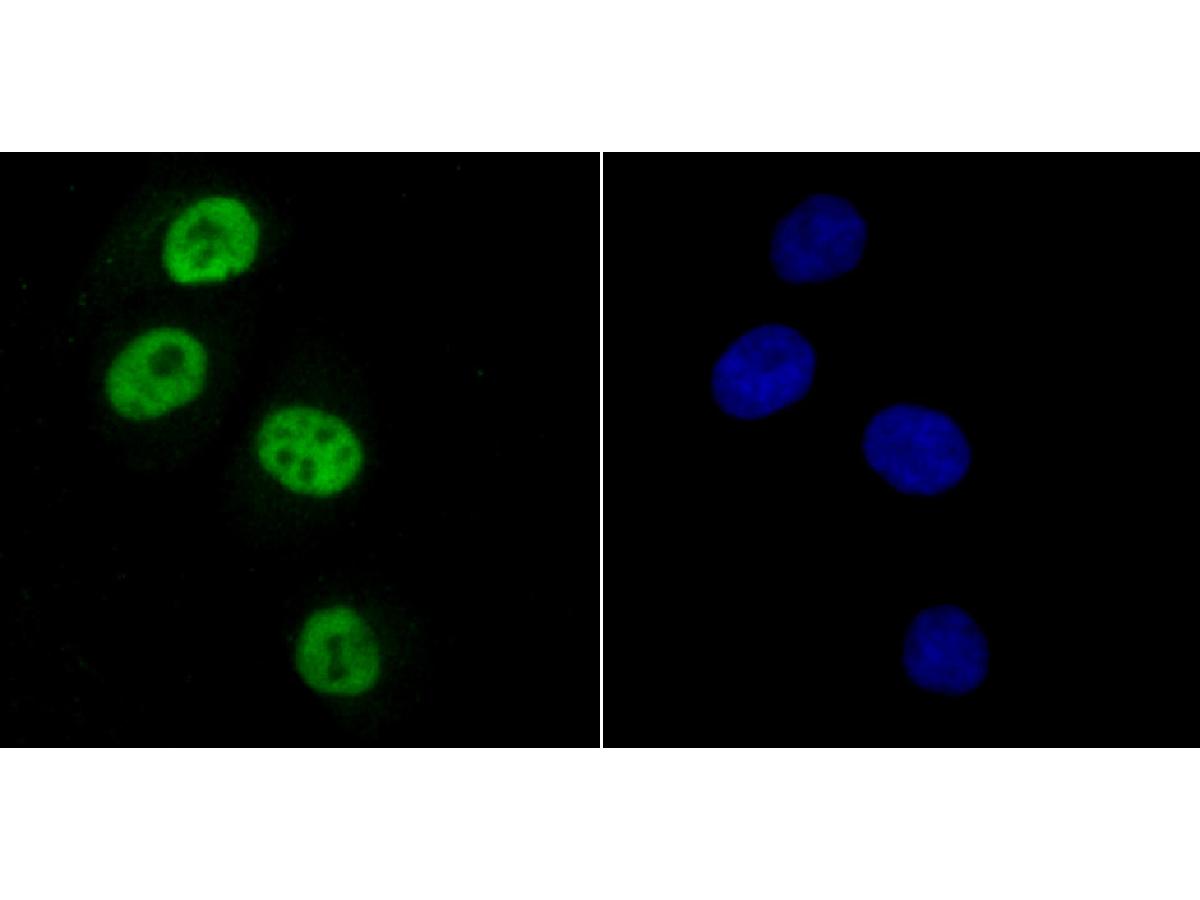 ICC staining of SAMHD1 in HUVEC cells (green). Formalin fixed cells were permeabilized with 0.1% Triton X-100 in TBS for 10 minutes at room temperature and blocked with 10% negative goat serum for 15 minutes at room temperature. Cells were probed with the primary antibody (ET1706-24, 1/50) for 1 hour at room temperature, washed with PBS. Alexa Fluor®488 conjugate-Goat anti-Rabbit IgG was used as the secondary antibody at 1/1,000 dilution. The nuclear counter stain is DAPI (blue).