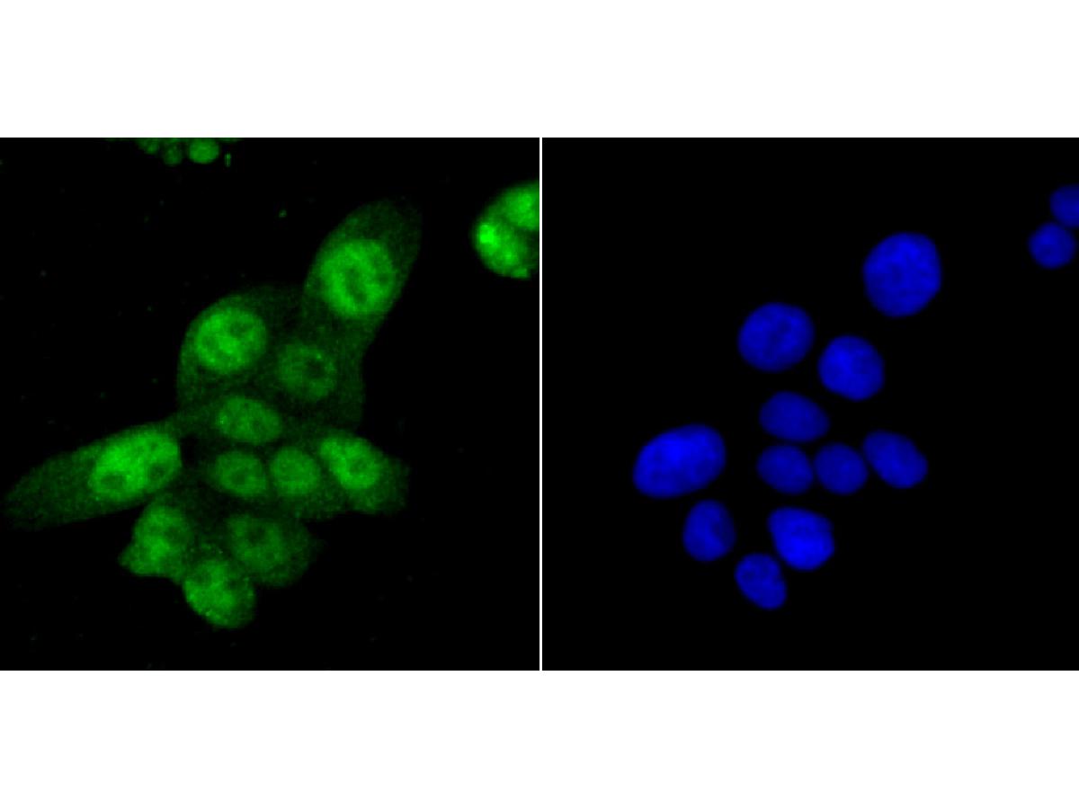 ICC staining of SAMHD1 in LOVO cells (green). Formalin fixed cells were permeabilized with 0.1% Triton X-100 in TBS for 10 minutes at room temperature and blocked with 10% negative goat serum for 15 minutes at room temperature. Cells were probed with the primary antibody (ET1706-24, 1/50) for 1 hour at room temperature, washed with PBS. Alexa Fluor®488 conjugate-Goat anti-Rabbit IgG was used as the secondary antibody at 1/1,000 dilution. The nuclear counter stain is DAPI (blue).