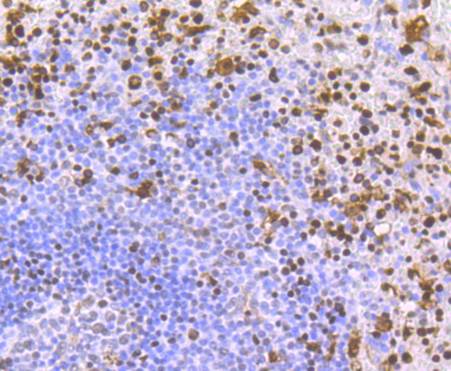 Immunohistochemical analysis of paraffin-embedded human spleen tissue using anti-SAMHD1 antibody. The section was pre-treated using heat mediated antigen retrieval with sodium citrate buffer (pH 6.0) for 20 minutes. The tissues were blocked in 1% BSA for 30 minutes at room temperature, washed with ddH2O and PBS, and then probed with the primary antibody (ET1706-24, 1/50)  for 30 minutes at room temperature. The detection was performed using an HRP conjugated compact polymer system. DAB was used as the chromogen. Tissues were counterstained with hematoxylin and mounted with DPX.