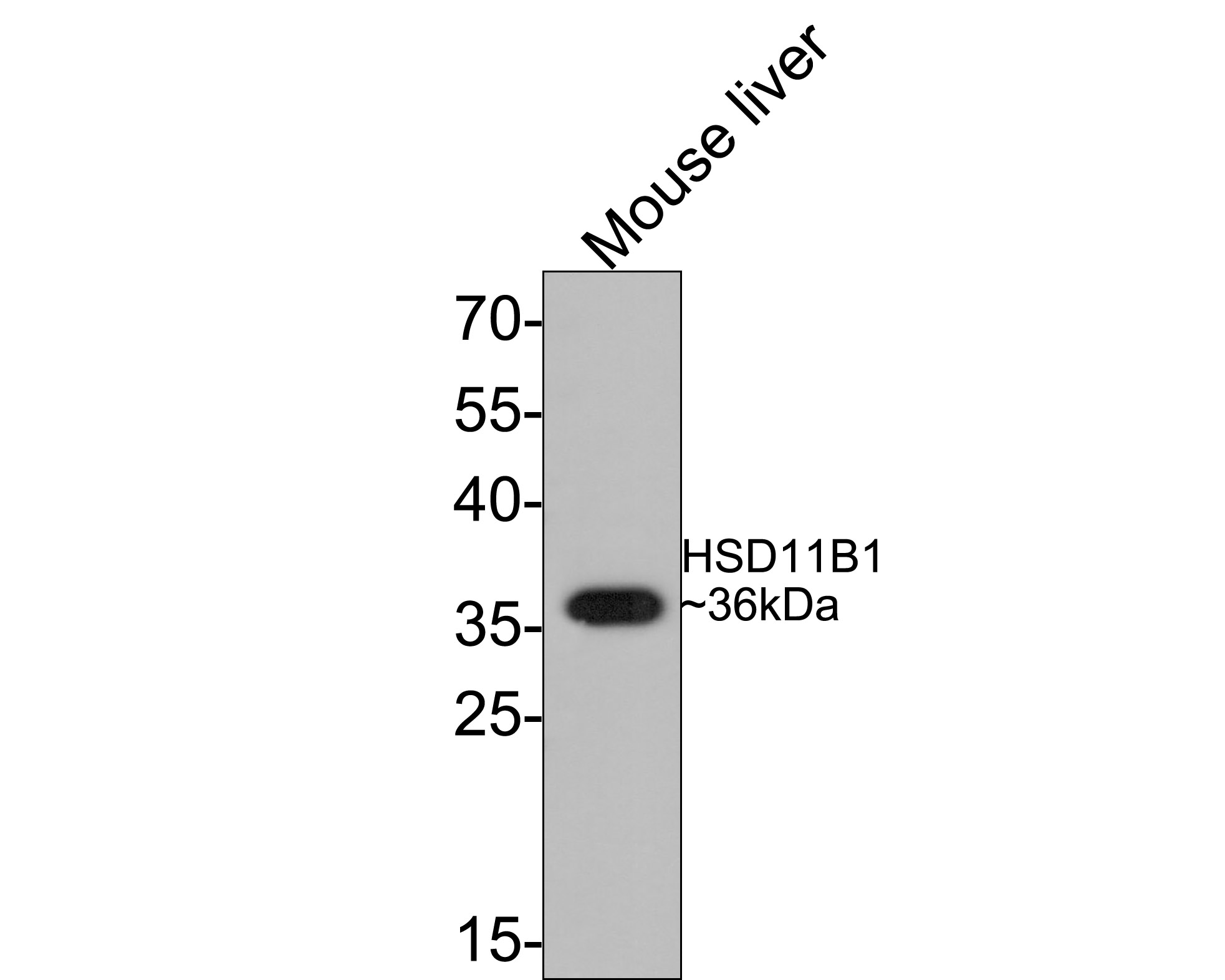 Western blot analysis of HSD11B1 on mouse liver tissue lysates with Rabbit anti-HSD11B1 antibody (ET1706-27) at 1/500 dilution.<br />
<br />
Lysates/proteins at 10 µg/Lane.<br />
<br />
Predicted band size: 32 kDa<br />
Observed band size: 36 kDa<br />
<br />
Exposure time: 2 minutes;<br />
<br />
12% SDS-PAGE gel.<br />
<br />
Proteins were transferred to a PVDF membrane and blocked with 5% NFDM/TBST for 1 hour at room temperature. The primary antibody (ET1706-27) at 1/500 dilution was used in 5% NFDM/TBST at room temperature for 2 hours. Goat Anti-Rabbit IgG - HRP Secondary Antibody (HA1001) at 1:200,000 dilution was used for 1 hour at room temperature.