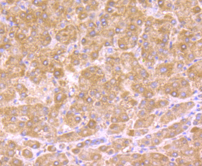 Immunohistochemical analysis of paraffin-embedded human liver tissue with Rabbit anti-HSD11B1 antibody (ET1706-27) at 1/400 dilution.<br />
<br />
The section was pre-treated using heat mediated antigen retrieval with Tris-EDTA buffer (pH 9.0) for 20 minutes. The tissues were blocked in 1% BSA for 20 minutes at room temperature, washed with ddH2O and PBS, and then probed with the primary antibody (ET1706-27) at 1/400 dilution for 1 hour at room temperature. The detection was performed using an HRP conjugated compact polymer system. DAB was used as the chromogen. Tissues were counterstained with hematoxylin and mounted with DPX.
