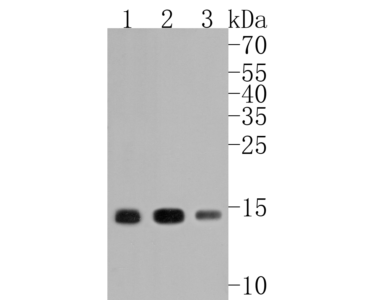 Western blot analysis of Histone H3 (acetyl K14) on different lysates with Rabbit anti-Histone H3 (acetyl K14) antibody (ET1706-28) at 1/500 dilution.<br />
<br />
Lane 1: Jurkat cell lysate(10 µg/Lane)<br />
Lane 2: Rat liver tissue lysate<br />
Lane 3: Mouse lung tissue lysate<br />
<br />
Lysates/proteins at 20 µg/Lane.<br />
<br />
Predicted band size: 15 kDa<br />
Observed band size: 15 kDa<br />
<br />
Exposure time: 2 minutes;<br />
<br />
15% SDS-PAGE gel.<br />
<br />
Proteins were transferred to a PVDF membrane and blocked with 5% NFDM/TBST for 1 hour at room temperature. The primary antibody (ET1706-28) at 1/500 dilution was used in 5% NFDM/TBST at room temperature for 2 hours. Goat Anti-Rabbit IgG - HRP Secondary Antibody (HA1001) at 5,000 dilution was used for 1 hour at room temperature.