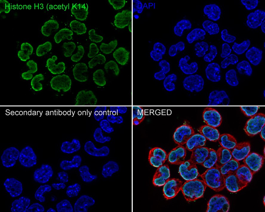 Immunocytochemistry analysis of Hela cells labeling Histone H3 (acetyl K14) with Rabbit anti-Histone H3 (acetyl K14) antibody (ET1706-28) at 1/50 dilution.<br />
<br />
Cells were fixed in 4% paraformaldehyde for 10 minutes at 37 ℃, permeabilized with 0.05% Triton X-100 in PBS for 20 minutes, and then blocked with 2% negative goat serum for 30 minutes at room temperature. Cells were then incubated with Rabbit anti-Histone H3 (acetyl K14) antibody (ET1706-28) at 1/50 dilution in 2% negative goat serum overnight at 4 ℃. Alexa Fluor®488 conjugate-Goat anti-Rabbit IgG was used as the secondary antibody at 1/1,000 dilution. Nuclear DNA was labelled in blue with DAPI.