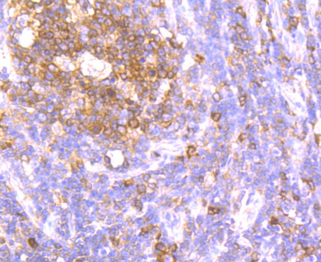 Immunohistochemical analysis of paraffin-embedded  human tonsil tissue with Rabbit anti-Apg3 antibody (ET1706-29) at 1/100 dilution.<br />
<br />
The section was pre-treated using heat mediated antigen retrieval with sodium citrate buffer (pH 6.0) for 2 minutes. The tissues were blocked in 1% BSA for 20 minutes at room temperature, washed with ddH2O and PBS, and then probed with the primary antibody (ET1706-29) at 1/100 dilution for 1 hour at room temperature. The detection was performed using an HRP conjugated compact polymer system. DAB was used as the chromogen. Tissues were counterstained with hematoxylin and mounted with DPX.