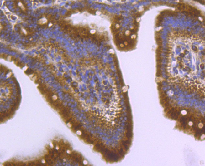 Immunohistochemical analysis of paraffin-embedded mouse small intestine tissue using anti-Apg3 antibody. The section was pre-treated using heat mediated antigen retrieval with sodium citrate buffer (pH 6.0) for 20 minutes. The tissues were blocked in 5% BSA for 30 minutes at room temperature, washed with ddH2O and PBS, and then probed with the primary antibody (ET1706-29, 1/100) for 30 minutes at room temperature. The detection was performed using an HRP conjugated compact polymer system. DAB was used as the chromogen. Tissues were counterstained with hematoxylin and mounted with DPX.