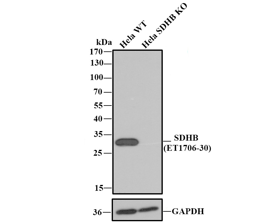 All lanes: Western blot analysis of SDHB with anti-SDHB antibody [JU02-33] (ET1706-30) at 1:1,000 dilution.<br />
<br />
Lane 1: Wild-type Hela whole cell lysate.<br />
Lane 2: SDHB knockout Hela whole cell lysate.<br />
<br />
ET1706-30 was shown to specifically react with SDHB in wild-type Hela cells. No band was observed when SDHB knockout samples were tested. Wild-type and SDHB knockout samples were subjected to SDS-PAGE. Proteins were transferred to a PVDF membrane and blocked with 5% NFDM in TBST for 1 hour at room temperature. The primary Anti-SDHB antibody (ET1706-30, 1/1,000) and Anti-GAPDH antibody (ET1601-4, 1/10,000) were used in 5% BSA at room temperature for 2 hours. Goat Anti-Rabbit IgG H&L (HRP) Secondary Antibody (HA1001) at 1:200,000 dilution was used for 1 hour at room temperature.<br />
<br />
Cell lysate was provided by Ubigene Biosciences (Ubigene Biosciences Co., Ltd., Guangzhou, China).