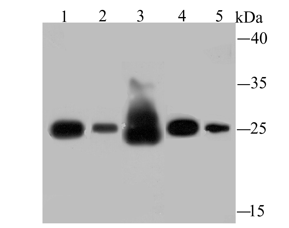 Western blot analysis of SDHB on different lysates with Rabbit anti-SDHB antibody (ET1706-30) at 1/500 dilution.<br />
  <br />
Lane 1: Human liver lysate<br />
Lane 2: Rat spleen lysate<br />
Lane 3: Rat liver lysate<br />
Lane 4: Mouse spleen lysate<br />
Lane 5: HepG2 cell lysate(20 µg/Lane)<br />
<br />
Lysates/proteins at 20 µg/Lane.<br />
<br />
Predicted band size: 32 kDa<br />
Observed band size: 25 kDa<br />
<br />
Exposure time: 2 minutes;<br />
<br />
15% SDS-PAGE gel.<br />
<br />
Proteins were transferred to a PVDF membrane and blocked with 5% NFDM/TBST for 1 hour at room temperature. The primary antibody (ET1706-30) at 1/500 dilution was used in 5% NFDM/TBST at room temperature for 2 hours. Goat Anti-Rabbit IgG - HRP Secondary Antibody (HA1001) at 5,000 dilution was used for 1 hour at room temperature.