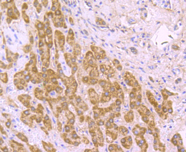 Immunohistochemical analysis of paraffin-embedded human liver tissue with Rabbit anti-SDHB antibody (ET1706-30) at 1/50 dilution.<br />
<br />
The section was pre-treated using heat mediated antigen retrieval with Tris-EDTA buffer (pH 9.0) for 20 minutes. The tissues were blocked in 1% BSA for 20 minutes at room temperature, washed with ddH2O and PBS, and then probed with the primary antibody (ET1706-30) at 1/50 dilution for 0.5 hour at room temperature. The detection was performed using an HRP conjugated compact polymer system. DAB was used as the chromogen. Tissues were counterstained with hematoxylin and mounted with DPX.