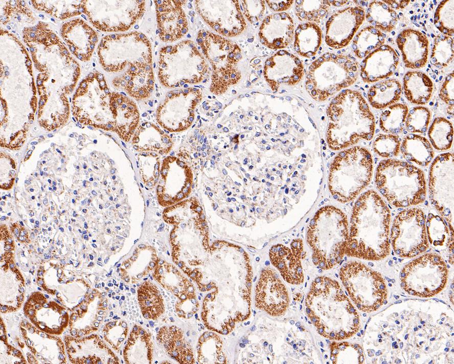 Immunohistochemical analysis of paraffin-embedded human kidney  tissue with Rabbit anti-SDHB antibody (ET1706-30) at 1/1,000 dilution.<br />
<br />
The section was pre-treated using heat mediated antigen retrieval with Tris-EDTA buffer (pH 9.0) for 20 minutes. The tissues were blocked in 1% BSA for 20 minutes at room temperature, washed with ddH2O and PBS, and then probed with the primary antibody (ET1706-30) at 1/1,000 dilution for 0.5 hour at room temperature. The detection was performed using an HRP conjugated compact polymer system. DAB was used as the chromogen. Tissues were counterstained with hematoxylin and mounted with DPX.