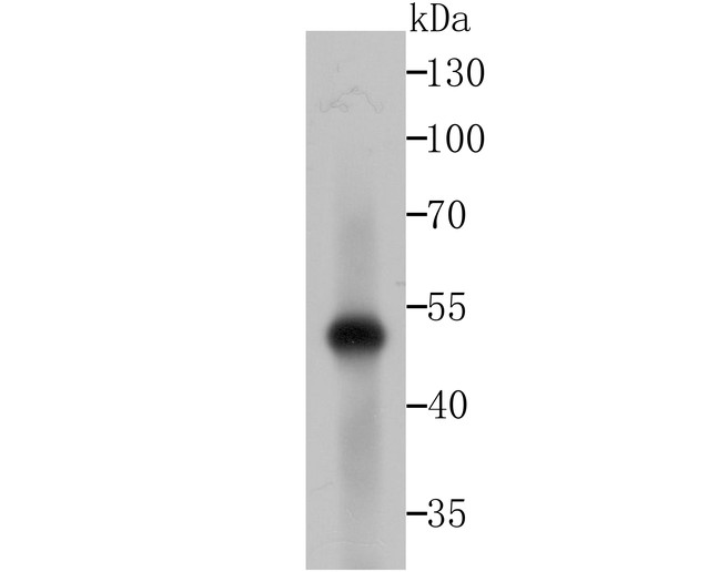 Western blot analysis of LOX on zebrafish tissue lysates with Rabbit anti-LOX antibody (ET1706-31) at 1/500 dilution.<br />
<br />
Lysates/proteins at 20 µg/Lane.<br />
<br />
Predicted band size: 50 kDa<br />
Observed band size: 50 kDa<br />
<br />
Exposure time: 2 minutes;<br />
<br />
10% SDS-PAGE gel.<br />
<br />
Proteins were transferred to a PVDF membrane and blocked with 5% NFDM/TBST for 1 hour at room temperature. The primary antibody (ET1706-31) at 1/500 dilution was used in 5% NFDM/TBST at room temperature for 2 hours. Goat Anti-Rabbit IgG - HRP Secondary Antibody (HA1001) at 1:200,000 dilution was used for 1 hour at room temperature.