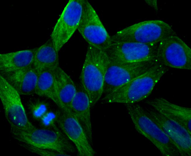 ICC staining of LOX in Hela cells (green). Formalin fixed cells were permeabilized with 0.1% Triton X-100 in TBS for 10 minutes at room temperature and blocked with 10% negative goat serum for 15 minutes at room temperature. Cells were probed with the primary antibody (ET1706-31, 1/50) for 1 hour at room temperature, washed with PBS. Alexa Fluor®488 conjugate-Goat anti-Rabbit IgG was used as the secondary antibody at 1/1,000 dilution. The nuclear counter stain is DAPI (blue).