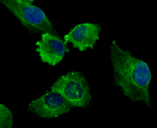 ICC staining of LOX in HUVEC cells (green). Formalin fixed cells were permeabilized with 0.1% Triton X-100 in TBS for 10 minutes at room temperature and blocked with 10% negative goat serum for 15 minutes at room temperature. Cells were probed with the primary antibody (ET1706-31, 1/50) for 1 hour at room temperature, washed with PBS. Alexa Fluor®488 conjugate-Goat anti-Rabbit IgG was used as the secondary antibody at 1/1,000 dilution. The nuclear counter stain is DAPI (blue).