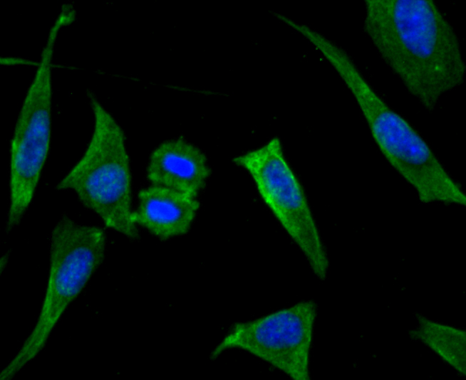ICC staining of LOX in SH-SY5Y cells (green). Formalin fixed cells were permeabilized with 0.1% Triton X-100 in TBS for 10 minutes at room temperature and blocked with 10% negative goat serum for 15 minutes at room temperature. Cells were probed with the primary antibody (ET1706-31, 1/50) for 1 hour at room temperature, washed with PBS. Alexa Fluor®488 conjugate-Goat anti-Rabbit IgG was used as the secondary antibody at 1/1,000 dilution. The nuclear counter stain is DAPI (blue).