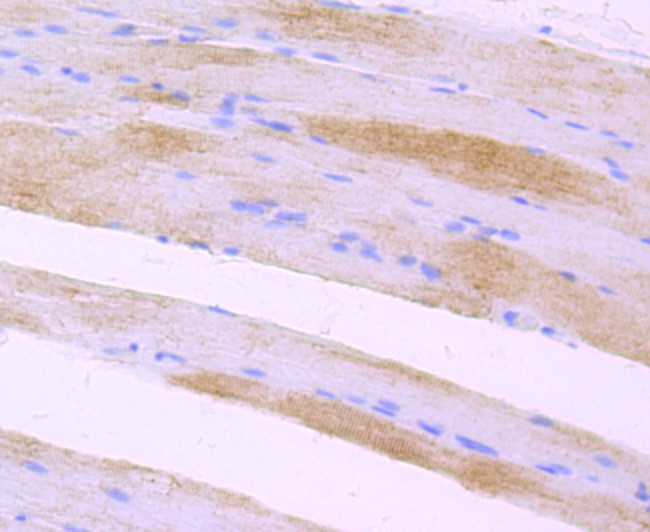 Immunohistochemical analysis of paraffin-embedded rat skeletal muscle tissue with Rabbit anti-LOX antibody (ET1706-31) at 1/50 dilution.<br />
<br />
The section was pre-treated using heat mediated antigen retrieval with Tris-EDTA buffer (pH 9.0) for 20 minutes. The tissues were blocked in 1% BSA for 20 minutes at room temperature, washed with ddH2O and PBS, and then probed with the primary antibody (ET1706-31) at 1/50 dilution for 0.5 hour at room temperature. The detection was performed using an HRP conjugated compact polymer system. DAB was used as the chromogen. Tissues were counterstained with hematoxylin and mounted with DPX.