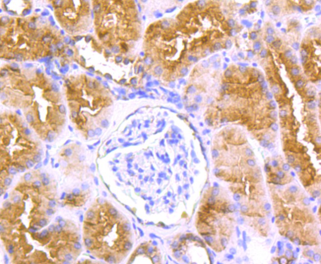 Immunohistochemical analysis of paraffin-embedded human kidney tissue with Rabbit anti-LOX antibody (ET1706-31) at 1/50 dilution.<br />
<br />
The section was pre-treated using heat mediated antigen retrieval with Tris-EDTA buffer (pH 9.0) for 20 minutes. The tissues were blocked in 1% BSA for 20 minutes at room temperature, washed with ddH2O and PBS, and then probed with the primary antibody (ET1706-31) at 1/50 dilution for 0.5 hour at room temperature. The detection was performed using an HRP conjugated compact polymer system. DAB was used as the chromogen. Tissues were counterstained with hematoxylin and mounted with DPX.
