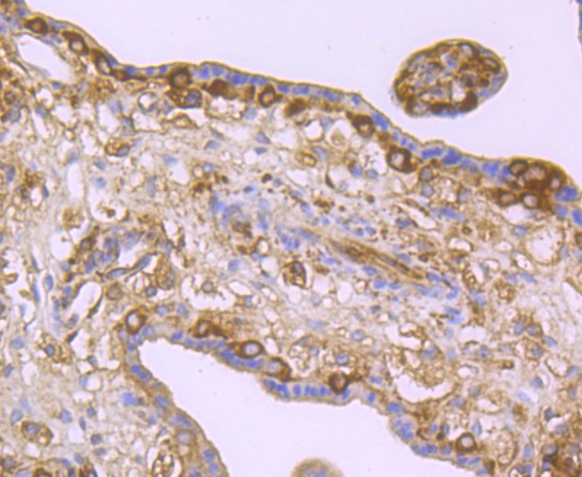 Immunohistochemical analysis of paraffin-embedded human placenta tissue with Rabbit anti-LOX antibody (ET1706-31) at 1/50 dilution.<br />
<br />
The section was pre-treated using heat mediated antigen retrieval with Tris-EDTA buffer (pH 9.0) for 20 minutes. The tissues were blocked in 1% BSA for 20 minutes at room temperature, washed with ddH2O and PBS, and then probed with the primary antibody (ET1706-31) at 1/50 dilution for 0.5 hour at room temperature. The detection was performed using an HRP conjugated compact polymer system. DAB was used as the chromogen. Tissues were counterstained with hematoxylin and mounted with DPX.