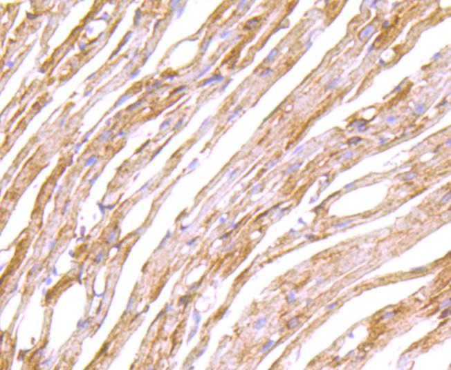 Immunohistochemical analysis of paraffin-embedded mouse heart tissue with Rabbit anti-LOX antibody (ET1706-31) at 1/50 dilution.<br />
<br />
The section was pre-treated using heat mediated antigen retrieval with Tris-EDTA buffer (pH 9.0) for 20 minutes. The tissues were blocked in 1% BSA for 20 minutes at room temperature, washed with ddH2O and PBS, and then probed with the primary antibody (ET1706-31) at 1/50 dilution for 0.5 hour at room temperature. The detection was performed using an HRP conjugated compact polymer system. DAB was used as the chromogen. Tissues were counterstained with hematoxylin and mounted with DPX.