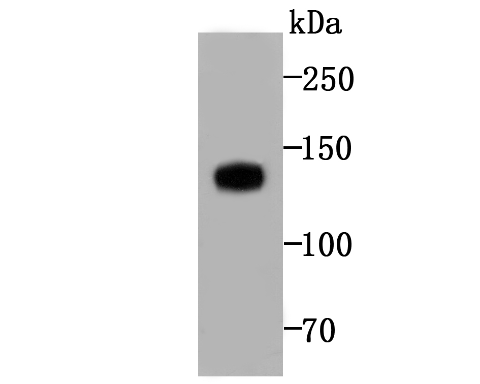 Western blot analysis of Involucrin on  human skin tissue lysates with Rabbit anti-Involucrin antibody (ET1706-32) at 1/500 dilution.<br />
<br />
Lysates/proteins at 20 µg/Lane.<br />
<br />
Predicted band size: 120 kDa<br />
Observed band size: 120 kDa<br />
<br />
Exposure time: 2 minutes;<br />
<br />
8% SDS-PAGE gel.<br />
<br />
Proteins were transferred to a PVDF membrane and blocked with 5% NFDM/TBST for 1 hour at room temperature. The primary antibody (ET1706-32) at 1/500 dilution was used in 5% NFDM/TBST at room temperature for 2 hours. Goat Anti-Rabbit IgG - HRP Secondary Antibody (HA1001) at 1:200,000 dilution was used for 1 hour at room temperature.