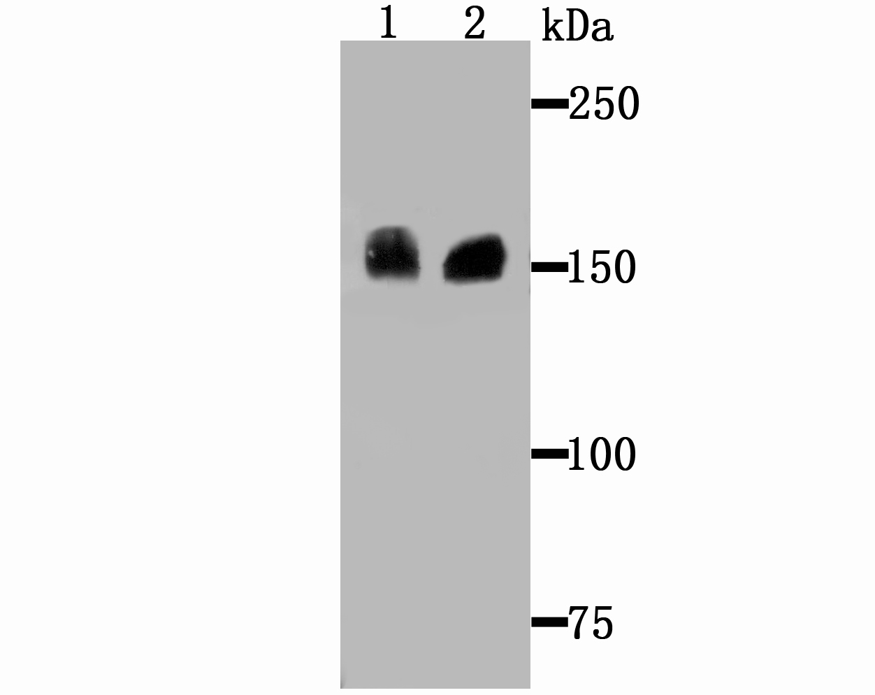 Western blot analysis of Drosha on different lysates. Proteins were transferred to a PVDF membrane and blocked with 5% BSA in PBS for 1 hour at room temperature. The primary antibody (ET1706-34, 1/500) was used in 5% BSA at room temperature for 2 hours. Goat Anti-Rabbit IgG - HRP Secondary Antibody (HA1001) at 1:200,000 dilution was used for 1 hour at room temperature.<br />
Positive control: <br />
Lane 1: Hela cell lysate<br />
Lane 2: SiHa cell lysate