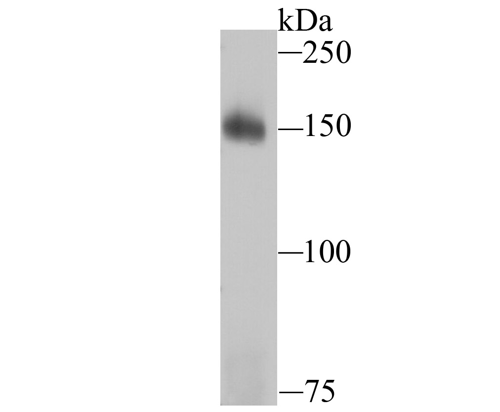 Western blot analysis of Drosha on K562 cell lysates. Proteins were transferred to a PVDF membrane and blocked with 5% BSA in PBS for 1 hour at room temperature. The primary antibody (ET1706-34, 1/500) was used in 5% BSA at room temperature for 2 hours. Goat Anti-Rabbit IgG - HRP Secondary Antibody (HA1001) at 1:200,000 dilution was used for 1 hour at room temperature.