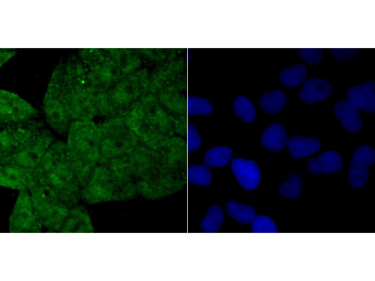 ICC staining of Drosha in Hela cells (green). Formalin fixed cells were permeabilized with 0.1% Triton X-100 in TBS for 10 minutes at room temperature and blocked with 10% negative goat serum for 15 minutes at room temperature. Cells were probed with the primary antibody (ET1706-34, 1/50) for 1 hour at room temperature, washed with PBS. Alexa Fluor®488 conjugate-Goat anti-Rabbit IgG was used as the secondary antibody at 1/1,000 dilution. The nuclear counter stain is DAPI (blue).