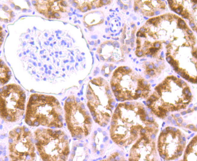 Immunohistochemical analysis of paraffin-embedded human kidney tissue using anti-Drosha antibody. The section was pre-treated using heat mediated antigen retrieval with Tris-EDTA buffer (pH 9.0) for 20 minutes.The tissues were blocked in 1% BSA for 30 minutes at room temperature, washed with ddH2O and PBS, and then probed with the primary antibody (ET1706-34, 1/50) for 30 minutes at room temperature. The detection was performed using an HRP conjugated compact polymer system. DAB was used as the chromogen. Tissues were counterstained with hematoxylin and mounted with DPX.