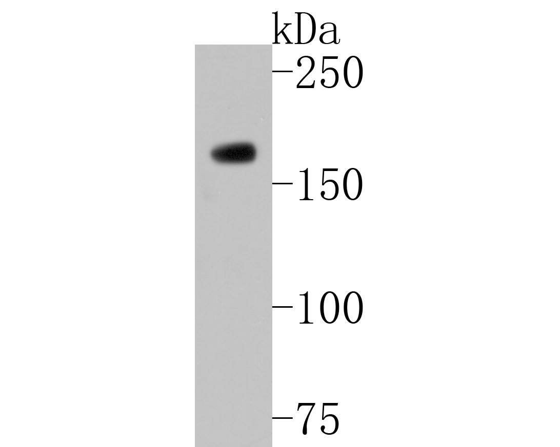Western blot analysis of HDAC9 on K562 cell lysates. Proteins were transferred to a PVDF membrane and blocked with 5% BSA in PBS for 1 hour at room temperature. The primary antibody (ET1706-36, 1/500) was used in 5% BSA at room temperature for 2 hours. Goat Anti-Rabbit IgG - HRP Secondary Antibody (HA1001) at 1:5,000 dilution was used for 1 hour at room temperature.
