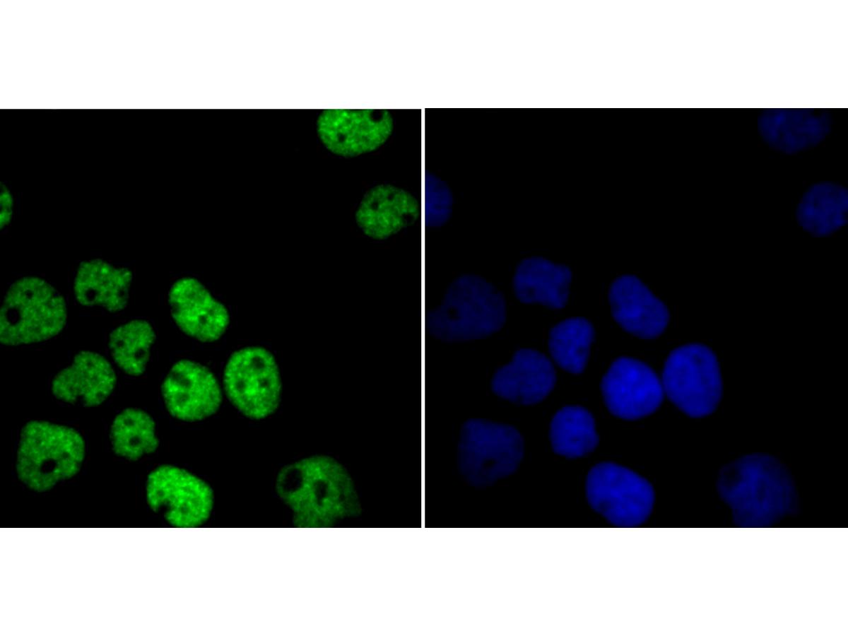 ICC staining of HDAC9 in A431 cells (green). Formalin fixed cells were permeabilized with 0.1% Triton X-100 in TBS for 10 minutes at room temperature and blocked with 1% Blocker BSA for 15 minutes at room temperature. Cells were probed with the primary antibody (ET1706-36, 1/50) for 1 hour at room temperature, washed with PBS. Alexa Fluor®488 Goat anti-Rabbit IgG was used as the secondary antibody at 1/1,000 dilution. The nuclear counter stain is DAPI (blue).